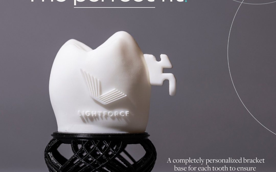 隐适美、传统牙套左右为难？3D打印定制托槽是您的最新选择！